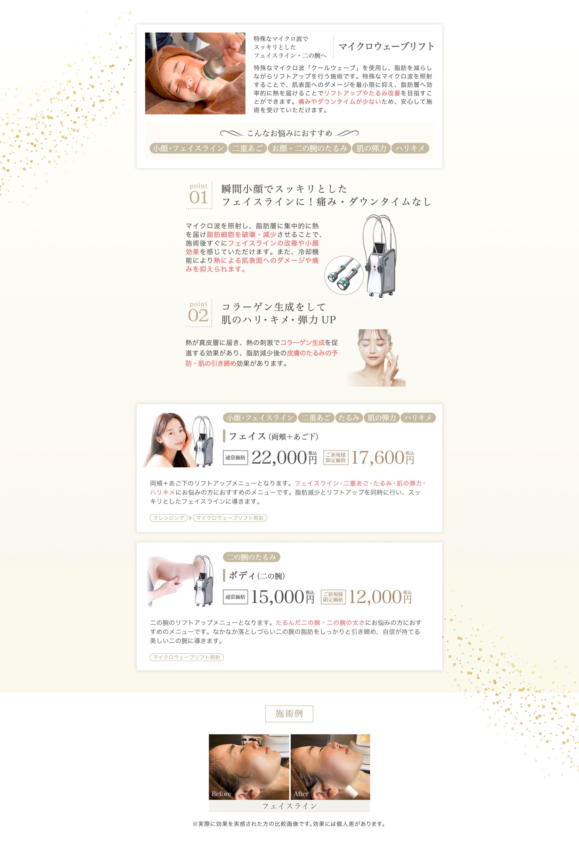 マイクロウェーブリフト